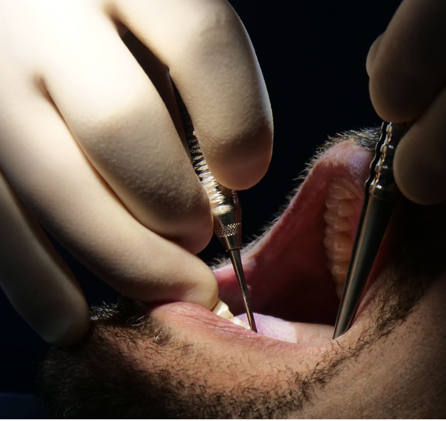 Patient receiving professional dental services at a modern clinic in London
